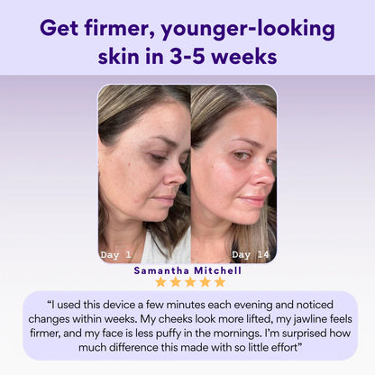 LumiLift™ V Sculpt Pro